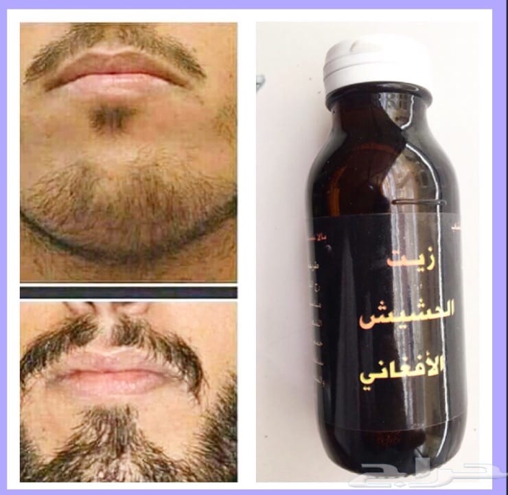 منتج الاصلي لجميع مشاكل الشعر الراس الذقن والشارب اللتي لم تصل لدرجة الصلع منتج اصلي ليسا دعايه
لا تنسَ أنك شاهدت هذا الإعلان في عنكبوت...