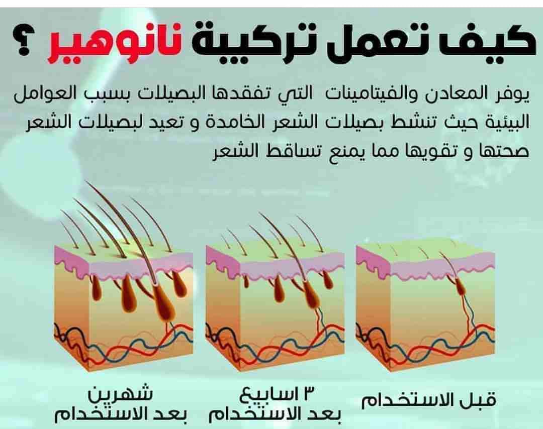 نانو هير التركي لتكثيف و نمو شعر الرأس
لا تنسَ أنك شاهدت هذا الإعلان في عنكبوت
نانو هير التركي لت...