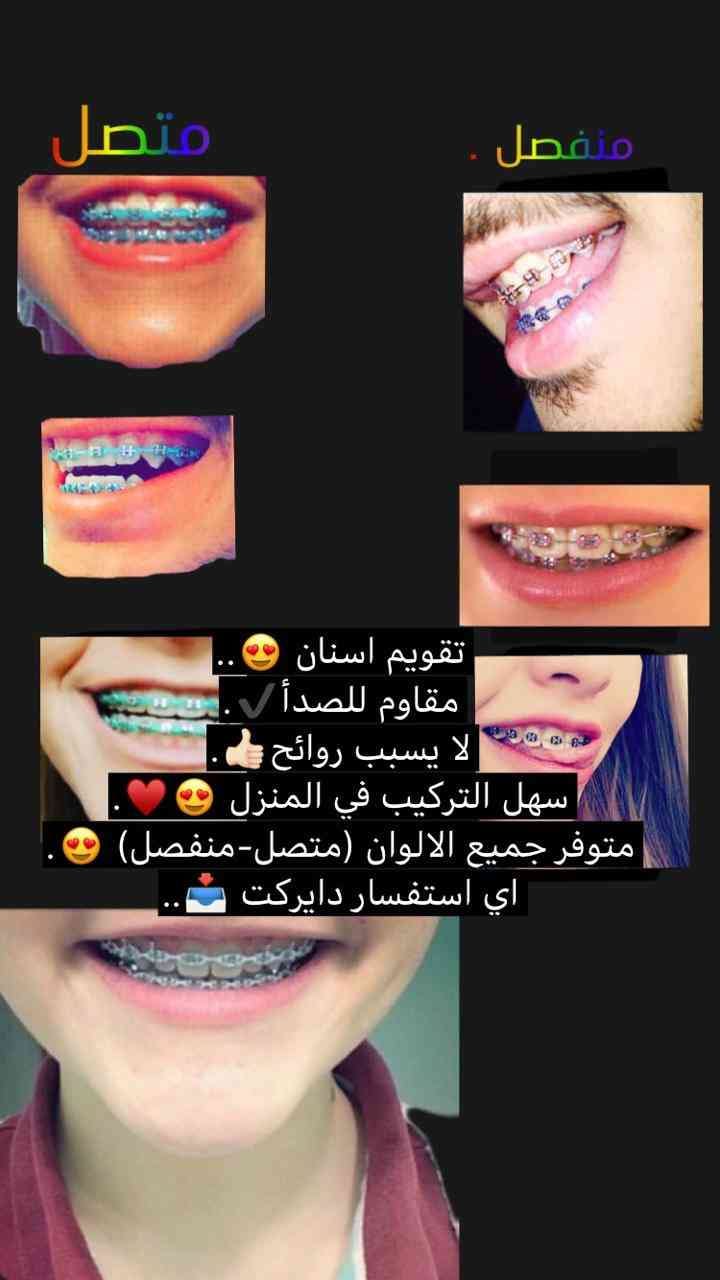 تقويم اسنان زينه
لا تنسَ أنك شاهدت هذا الإعلان في عنكبوت
تقويم اسنان زينه
متوفر بجميع الالوان...