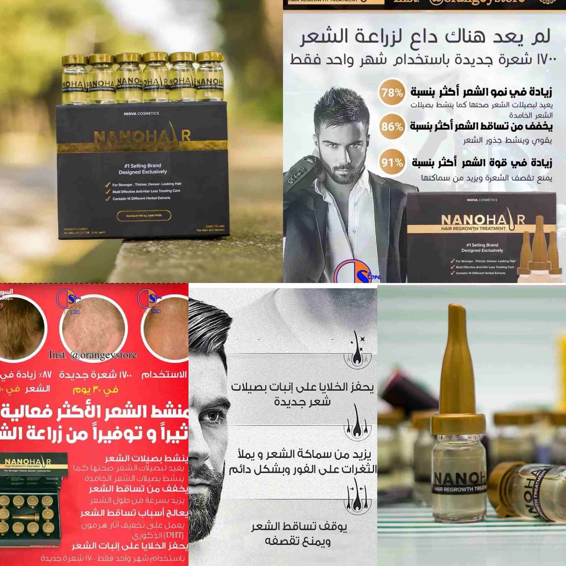 نانو هير التركي لتكثيف و نمو شعر الرأس
لا تنسَ أنك شاهدت هذا الإعلان في عنكبوت
نانو هير التركي لت...