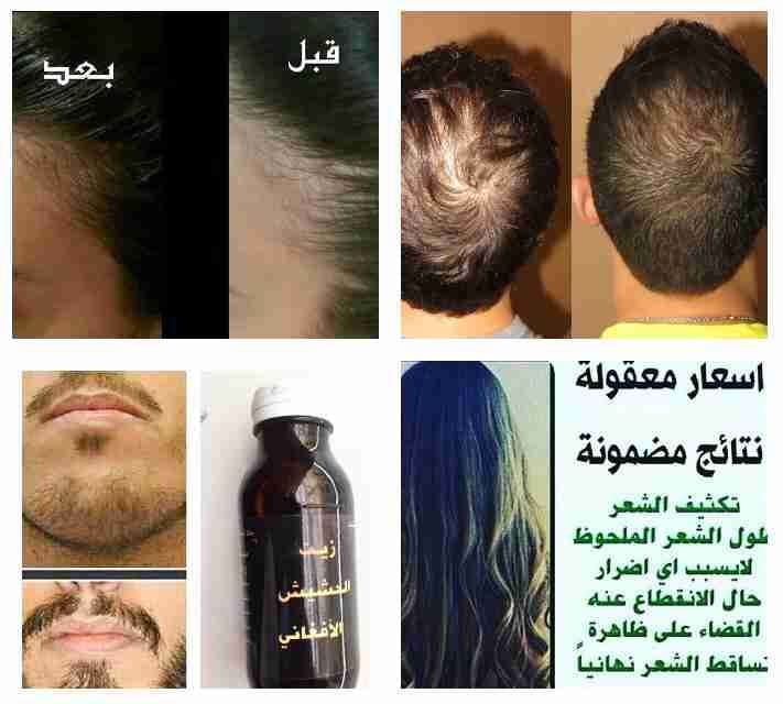 ززييتت الحششييشش الافغاني الاصلي مجرب فعال
لا تنسَ أنك شاهدت هذا الإعلان في عنكبوت
السلام علي...
