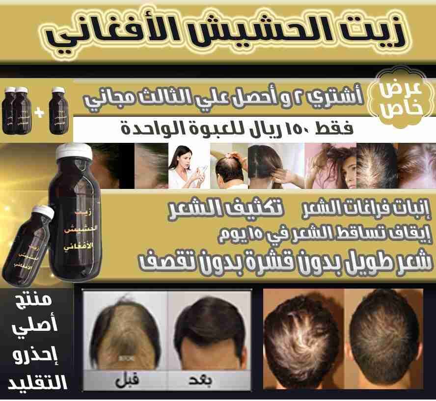 المنتج الاقوى ززييت الحششييشش الافغاني لتكثيف الشعر ومنع التقصف
لا تنسَ أنك شاهدت هذا الإعلان في عنكبوت...