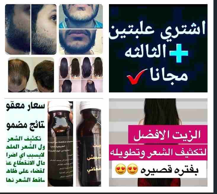 زييت الشعر الافغاني لتساقط الشعر اصلي و مجرب و فعال
لا تنسَ أنك شاهدت هذا الإعلان في عنكبوت
حصريا...