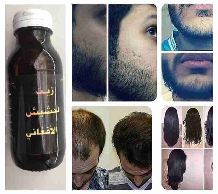 المنتج الاقوى ززييت الحششييشش الافغاني لتكثيف الشعر ومنع التقصف
لا تنسَ أنك شاهدت هذا الإعلان في عنكبوت...