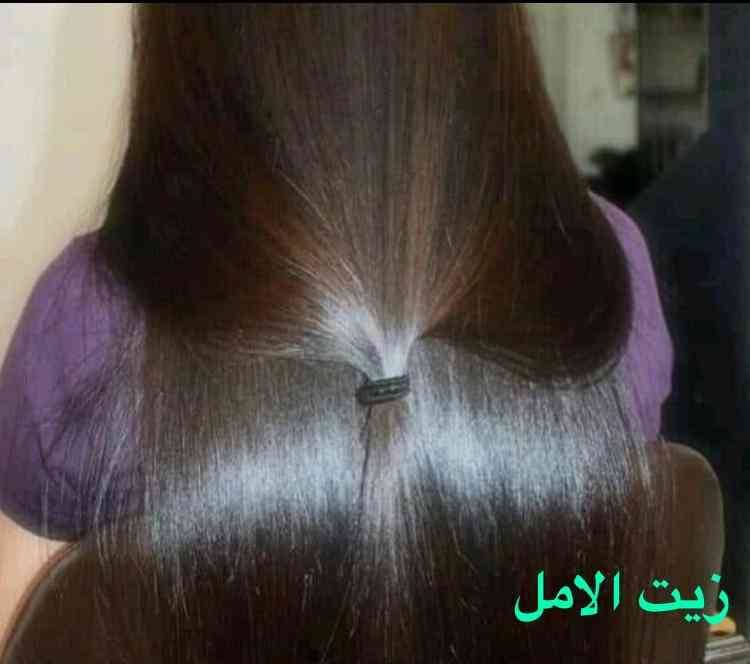 زيت الأمل لتنعيم الشعر وتطويله
لا تنسَ أنك شاهدت هذا الإعلان في عنكبوت
زيت الأمل
يساعد على ت...