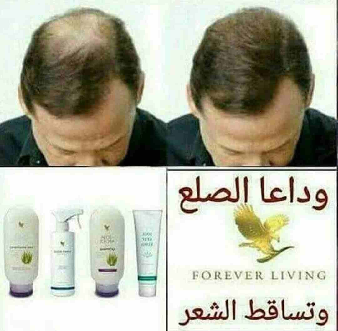 منتجات طبيعيه
لا تنسَ أنك شاهدت هذا الإعلان في عنكبوت
منتجات تجميل تنحيف وعلاجات للدوالي والاكزيم...