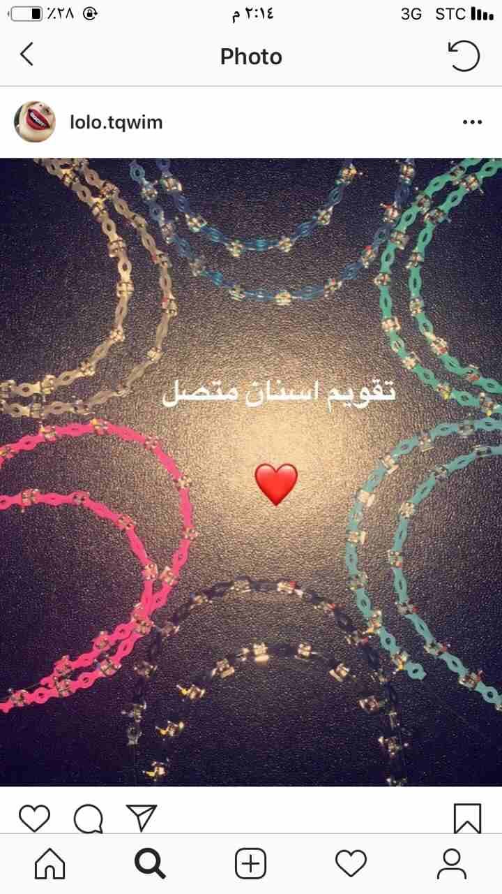 تقويم للبيع بسعر خاص كميه محدودة فكين مع لون
لا تنسَ أنك شاهدت هذا الإعلان في عنكبوت
تقويم تقويم...