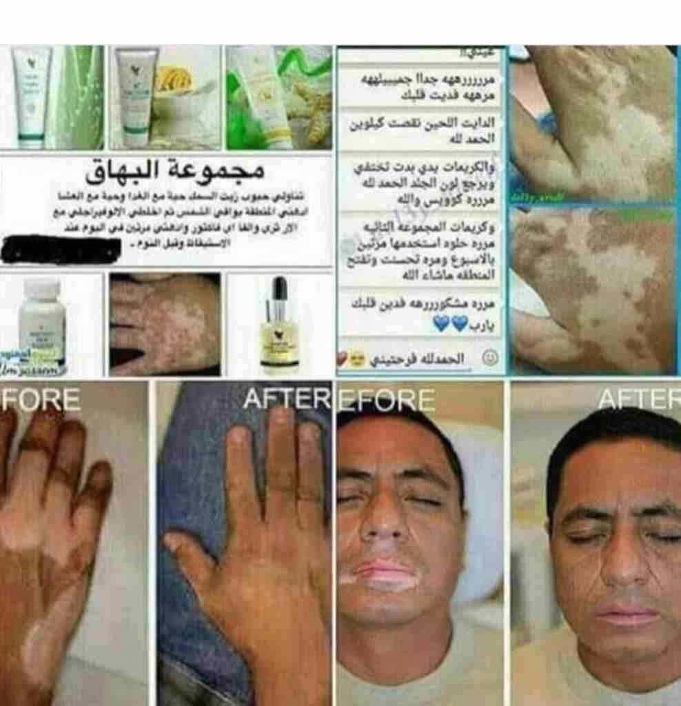 منتجات عنايه شخصيه طبيعيه 100 ٪
لا تنسَ أنك شاهدت هذا الإعلان في عنكبوت
منتجات وعلاجات للدوالي وا...