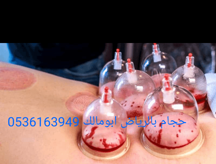 حجام بالرياض أبومالك 0536163949
*أخصائي للزيارات المنزلية
*خبرة ودراسة عملية أكثر من عشر سنوات
*أدوات جديدة ومعقمة لكل شخص
*جودة وإتقان - خبرة وأمان
*خدمة منزلية
*تكرار الحجامة اكثر من مرة للموضع
لل...