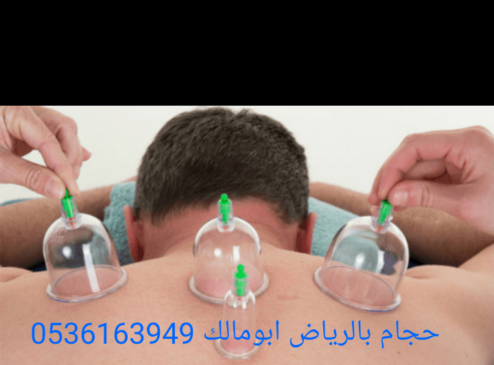 حجام بالرياض أبومالك 0536163949
*أخصائي للزيارات المنزلية
*خبرة ودراسة عملية أكثر من عشر سنوات
*أدوات جديدة ومعقمة لكل شخص
*جودة وإتقان - خبرة وأمان
*خدمة منزلية
*تكرار الحجامة اكثر من مرة للموضع
لل...