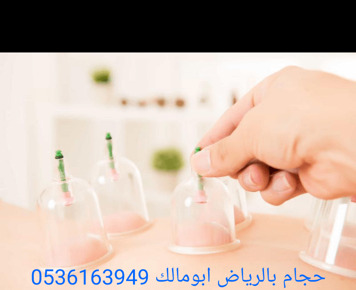 حجام بالرياض أبومالك 0536163949
*أخصائي للزيارات المنزلية
*خبرة ودراسة عملية أكثر من عشر سنوات
*أدوات جديدة ومعقمة لكل شخص
*جودة وإتقان - خبرة وأمان
*خدمة منزلية
*تكرار الحجامة اكثر من مرة للموضع
لل...