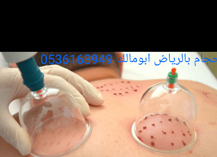 حجام بالرياض أبومالك 0536163949
*أخصائي للزيارات المنزلية
*خبرة ودراسة عملية أكثر من عشر سنوات
*أدوات جديدة ومعقمة لكل شخص
*جودة وإتقان - خبرة وأمان
*خدمة منزلية
*تكرار الحجامة اكثر من مرة للموضع
لل...